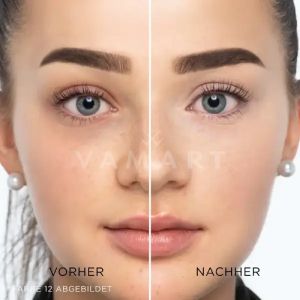 Artdeco Perfect Teint Concealer Светлоотразяващ течен коректор 7 refreshing beige